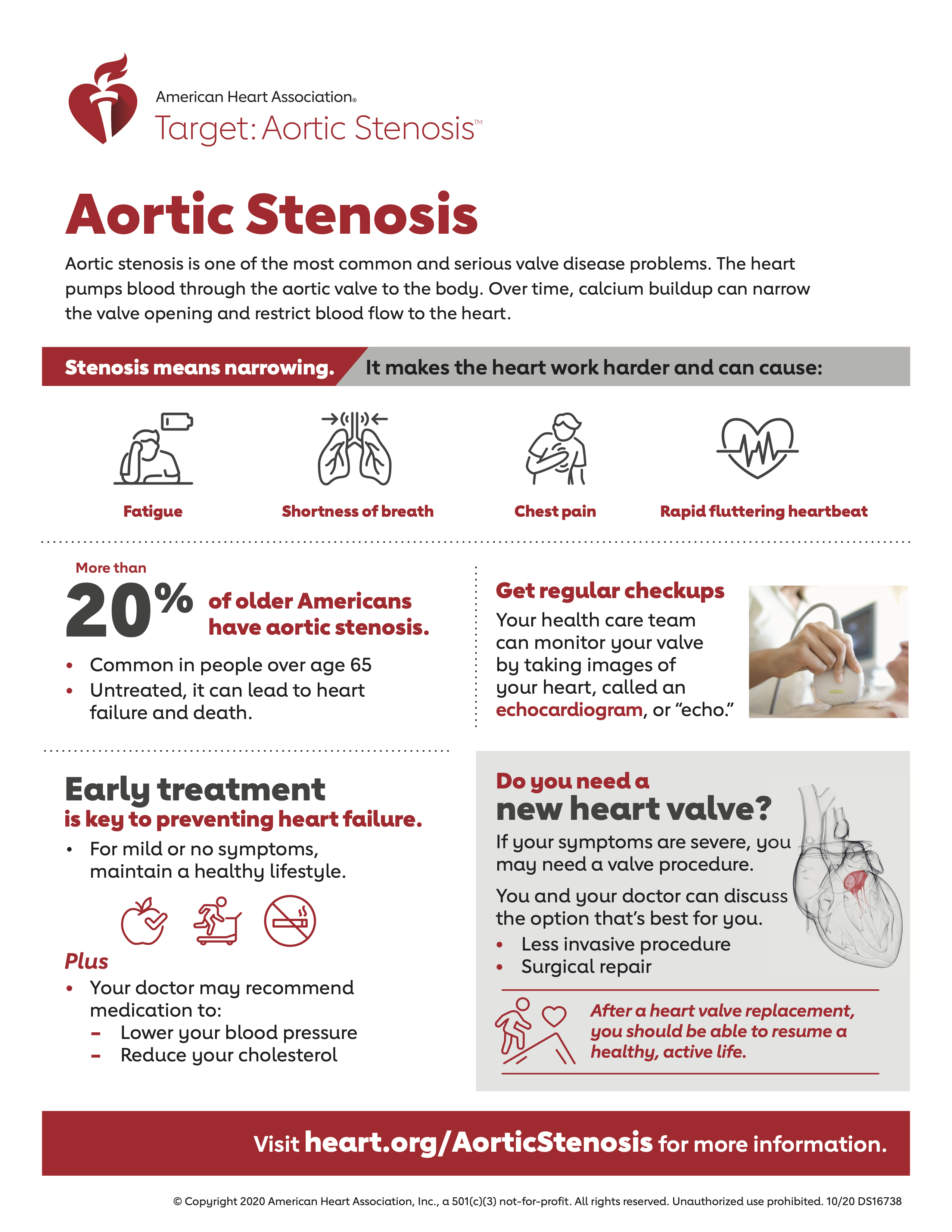 ABC-AHA Collaboration_Fact Sheet: Aortic Stenosis